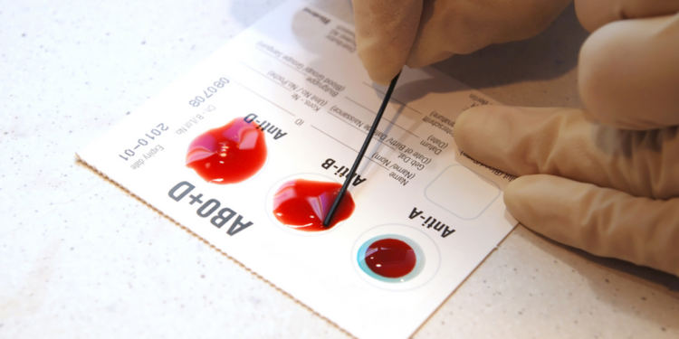 Are You A Member Of Blood Group O? See What It Means