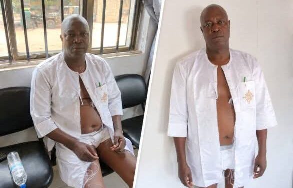 Suspected thugs beat, strip Ondo LG chairman