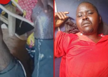 Vihiga man allegedly assaulted by employer while seeking pay pleads for help to get treatment