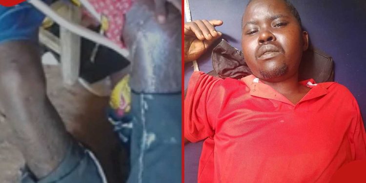Vihiga man allegedly assaulted by employer while seeking pay pleads for help to get treatment