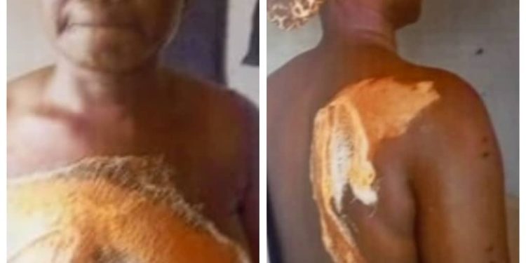 Housewife Pours Hot Water On Neighbour’s Wife During Public Fight Over Husband