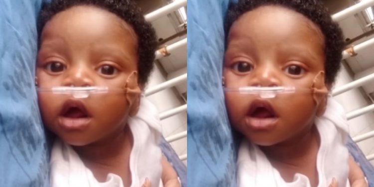 SO SAD!!! See The Baby Born With A Hole In The Heart And Needs Surgery