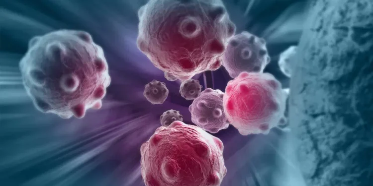 Experts demand patient navigators in all cancer centres